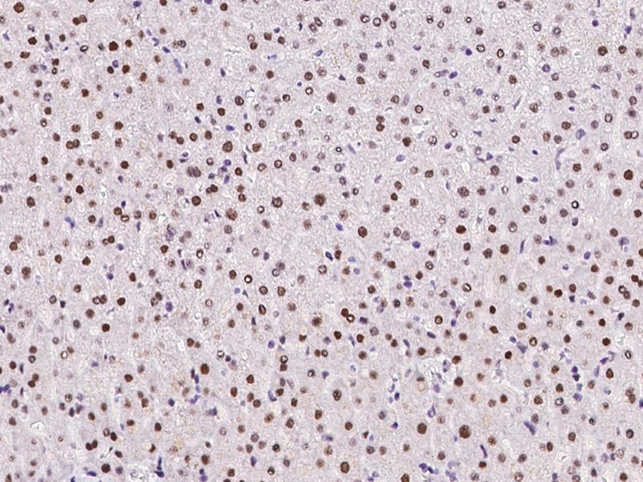 UCK1 Antibody