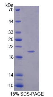 Human APLP1 / APLP-1 Protein (Recombinant His-T7)