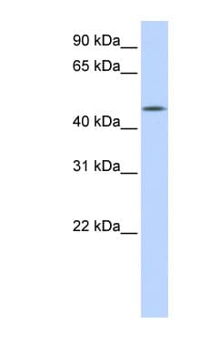 Polyclonal Rabbit anti-Human CCM2L Antibody (aa71-120, WB)