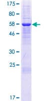 Human IYD Protein (Recombinant GST)