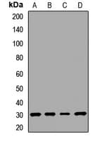 Polyclonal Rabbit anti-Human SCN1B Antibody (WB)