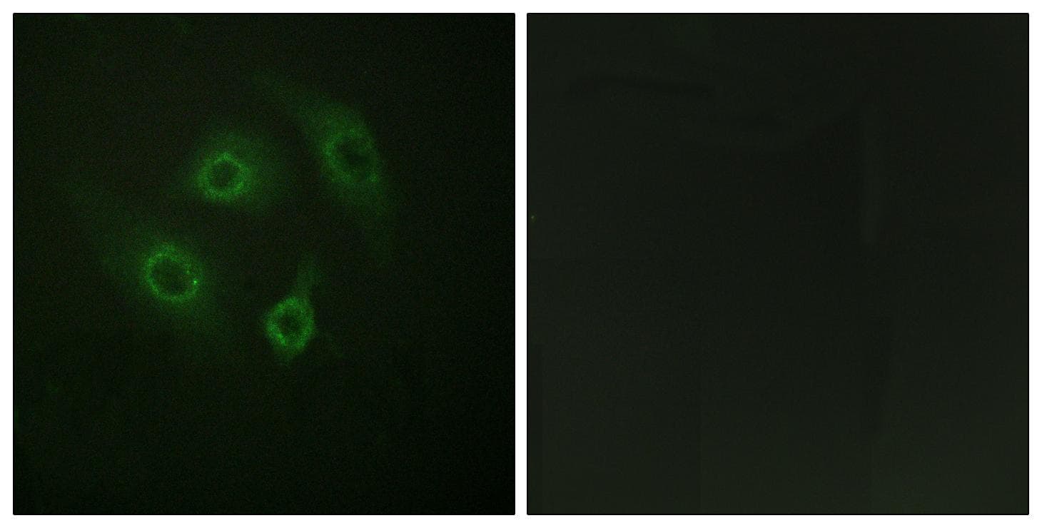 CD4 Antibody (phospho-Ser433)