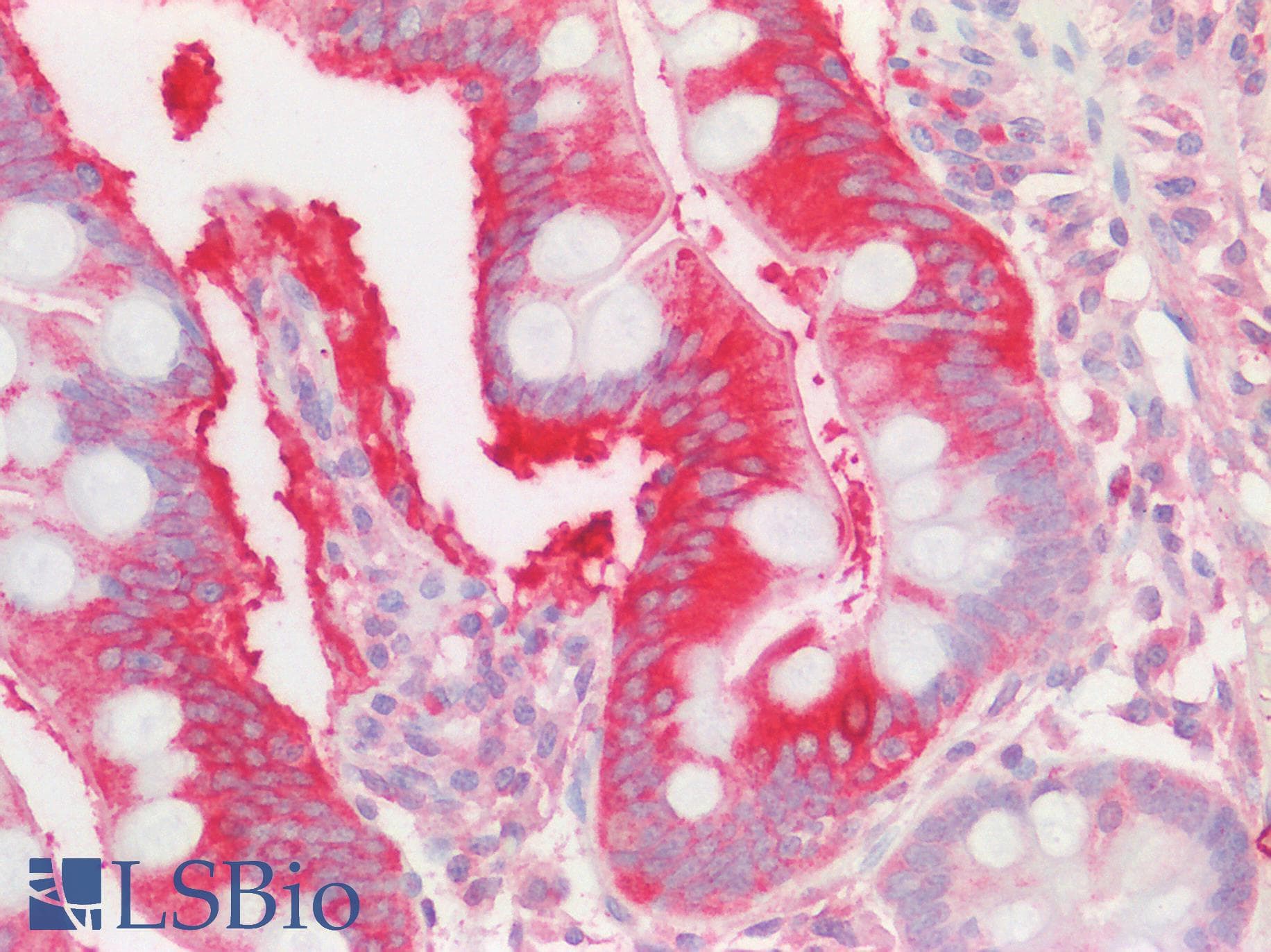 Polyclonal Rabbit anti-Human ALG11 Antibody (aa360-409, IHC, WB)