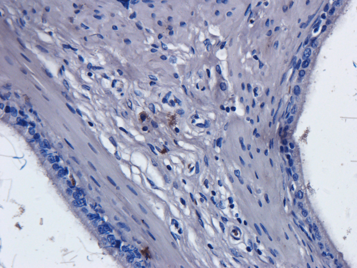 CD52 Antibody (CD52, clone Campath-1H)