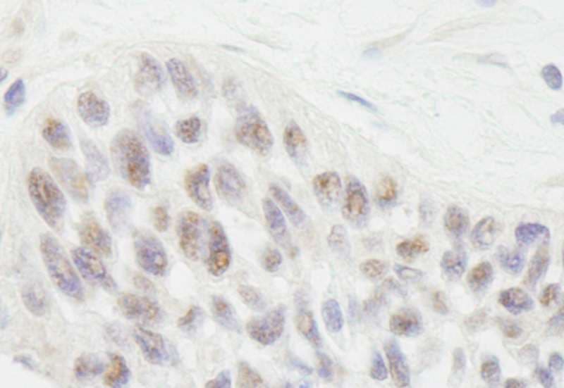 RIF1 Antibody (aa1-50)