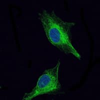 Monoclonal Mouse anti-Human OLIG2 Antibody (clone 1G11, IHC, IF, WB)