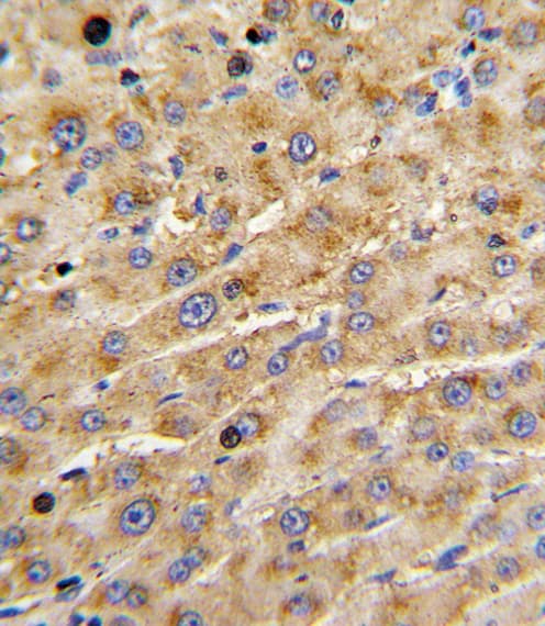 ADAMTS13 Antibody (aa829-858)