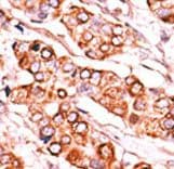 PDXK / PNK Antibody (aa242-272)