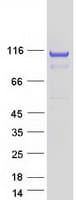 Human OGDH Protein (Recombinant Myc-DDK (Flag))