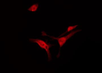 SYN / FYN Antibody (phospho-Tyr530)