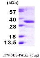 Human RDH12 / LCA3 Protein (Recombinant His)
