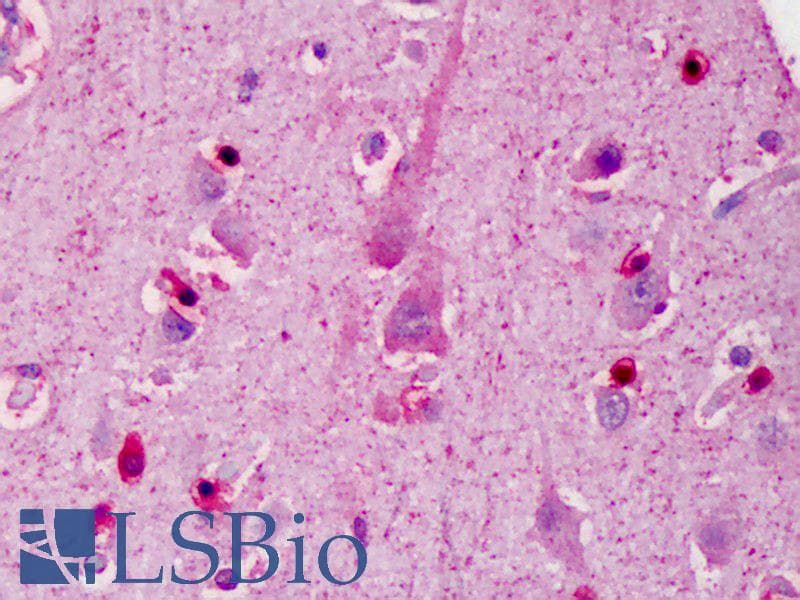 IHC-plus™ Polyclonal Rabbit anti-Human IRS1 Antibody (IHC, IF, WB)