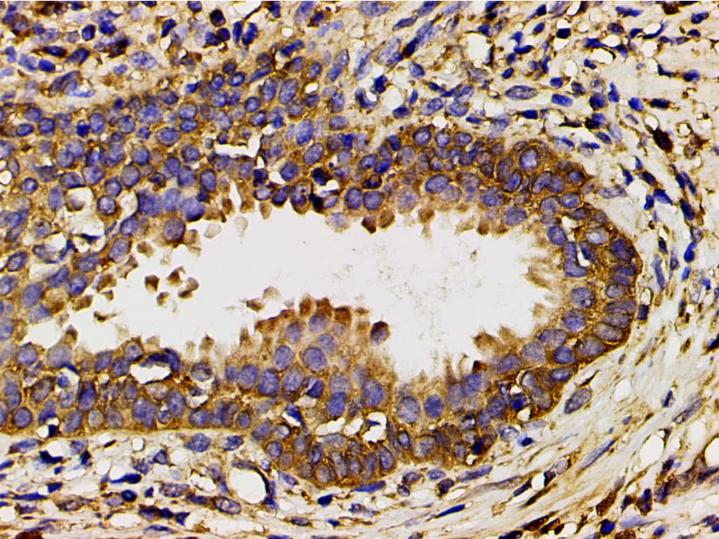 PIK3R1 / p85 Alpha Antibody (phospho-Tyr607)