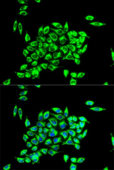 TRAP1 / HSP75 Antibody