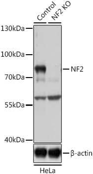 NF2 / Merlin Antibody