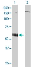 Monoclonal Mouse anti-Human P2RX5 / P2X5 Antibody (clone 1C5, WB)