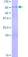 Human GSR / Glutathione Reductase Protein (Recombinant GST)