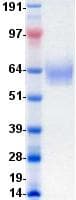 Human FGFR2 / FGF Receptor 2 Protein (Recombinant DDK (Flag)-His, C-terminus)