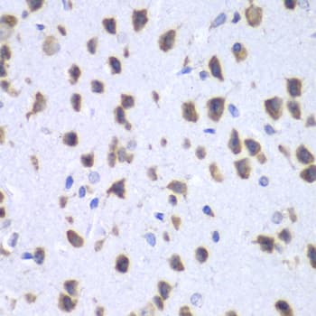 RENT1 / UPF1 Antibody