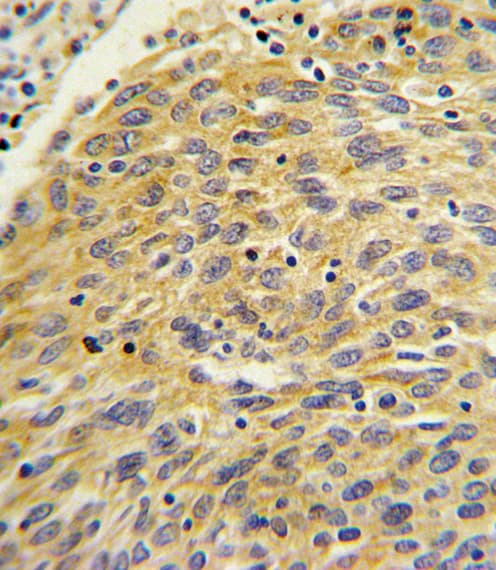 PLA2G4A Antibody (aa513-541)