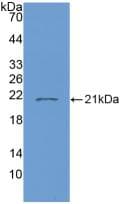 Human IL7 Protein (Recombinant His, N-Terminal)
