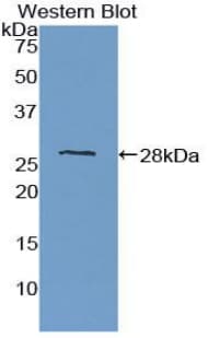 PTPRM / PTP Mu Antibody (aa1197-1403, Cy3)