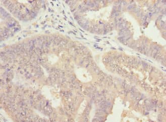 ALG2 Antibody