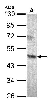 Polyclonal Rabbit anti-Human ACAD8 Antibody (aa146-415, WB)