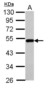 BLMH Antibody