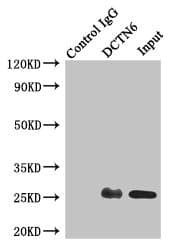 Polyclonal Rabbit anti-Human DCTN6 / Dynactin 6 Antibody (IHC, WB)