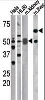 CDC25A Antibody (phospho-Ser75)