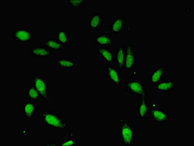 Polyclonal Rabbit anti-Human CDC45 Antibody (IHC, IF, WB)