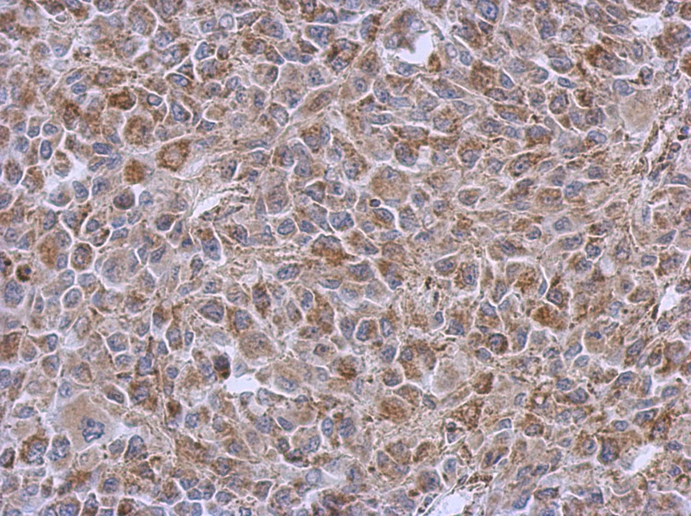 Polyclonal Rabbit anti-Human DLST / E2 Antibody (aa188-453, IHC, WB)