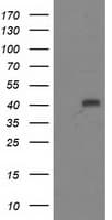 ADH2 / ADH1B Antibody (clone OTI3C12, Carrier-free)