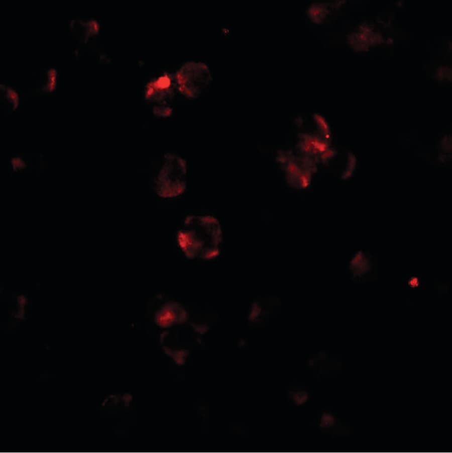 ABCA1 Antibody