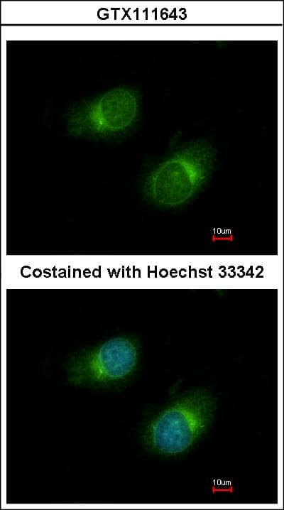 COL3A1 / Collagen III Antibody (aa1247-1389)