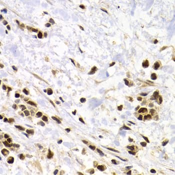 Polyclonal Rabbit anti-Human SUMO4 Antibody (IHC, WB)