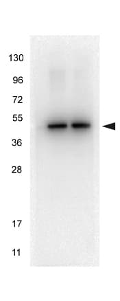 IHC-plus™ TUBA1B / Tubulin Alpha 1B Antibody (C-Terminus, clone 17H11.F10)