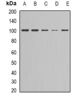 Polyclonal Rabbit anti-Human NFKB2 Antibody (C-Terminus, IHC, WB)