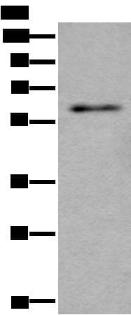 SCP2 / SCPX Antibody