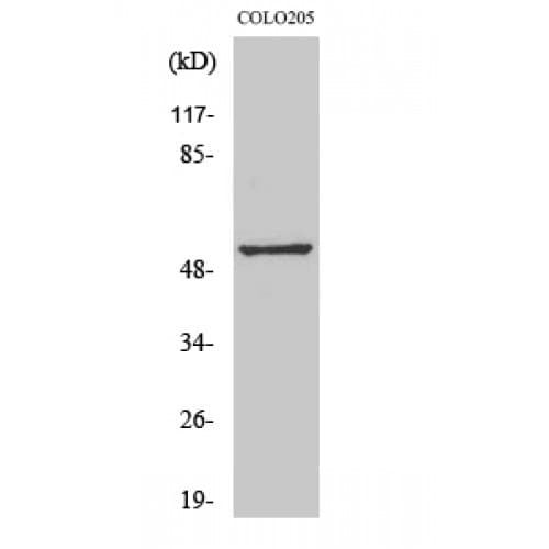 OPN4 / Melanopsin Antibody (400-480 aa, C-terminal)