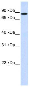 STAT5B Antibody (N-Terminus)