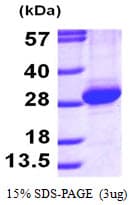 Human RAB11A Protein (Recombinant 6His, N-terminus)
