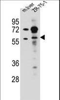Polyclonal Rabbit anti-Human TRIM62 Antibody (aa308-337, WB)