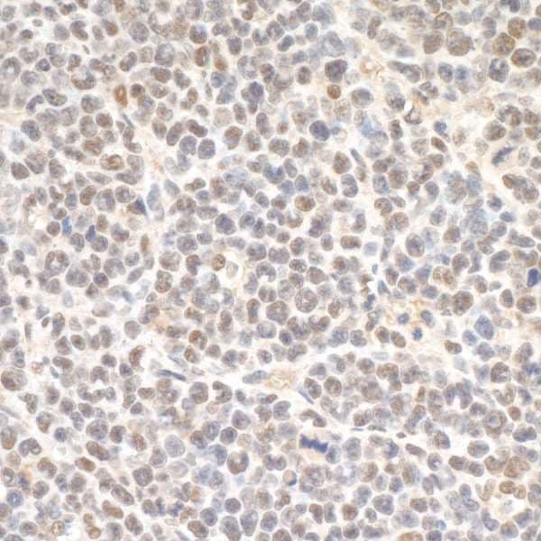 SMC3 / HCAP Antibody (aa1175-C-term)