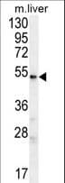 UGT3A2 Antibody (aa377-405)