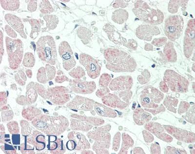 KCNIP2 / KCHIP2 Antibody (aa72-121)