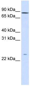 GPSM2 / LGN Antibody (aa72-121)