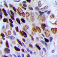 CBX3 / HP1 Gamma Antibody (Internal)