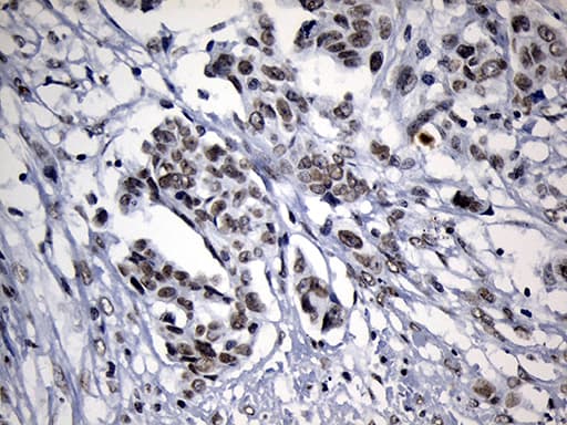 Monoclonal Mouse anti-Human ZNF705D Antibody (clone OTI1G1, IHC, WB)